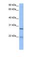 Epithelial Cell Transforming 2 antibody, orb330682, Biorbyt, Western Blot image 