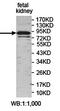 Rho GTPase Activating Protein 26 antibody, orb78357, Biorbyt, Western Blot image 