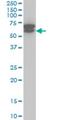 ETS Variant 6 antibody, H00002120-M01, Novus Biologicals, Western Blot image 