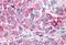 Neuropeptide Y Receptor Y1 antibody, GTX13067, GeneTex, Immunohistochemistry paraffin image 