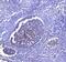 CD81 Molecule antibody, A01281-2, Boster Biological Technology, Immunohistochemistry paraffin image 