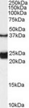 Galanin Receptor 1 antibody, TA303178, Origene, Western Blot image 