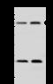 Adenosylhomocysteinase Like 1 antibody, GTX02194, GeneTex, Western Blot image 