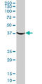 Phosphoglycerate Kinase 1 antibody, LS-C197888, Lifespan Biosciences, Western Blot image 