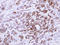MX Dynamin Like GTPase 1 antibody, LS-C186191, Lifespan Biosciences, Immunohistochemistry paraffin image 