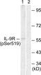 IL-9 receptor antibody, PA5-38621, Invitrogen Antibodies, Western Blot image 