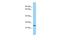 Pyroglutamyl-Peptidase I antibody, A13554, Boster Biological Technology, Western Blot image 