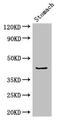 Adhesion Regulating Molecule 1 antibody, CSB-PA001396HA01HU, Cusabio, Western Blot image 