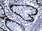 Caudal Type Homeobox 1 antibody, LS-C792501, Lifespan Biosciences, Immunohistochemistry paraffin image 
