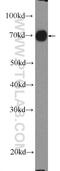 RDX antibody, 26105-1-AP, Proteintech Group, Western Blot image 