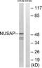 Nucleolar And Spindle Associated Protein 1 antibody, TA315450, Origene, Western Blot image 