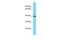 Coiled-coil domain-containing protein 86 antibody, PA5-46126, Invitrogen Antibodies, Western Blot image 