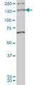 Myosin IIIA antibody, H00053904-M01, Novus Biologicals, Western Blot image 