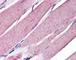 Myogenin antibody, 49-222, ProSci, Immunohistochemistry paraffin image 