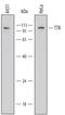 TTK Protein Kinase antibody, MAB6028, R&D Systems, Western Blot image 