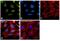 Protein Phosphatase, Mg2+/Mn2+ Dependent 1A antibody, PA5-29275, Invitrogen Antibodies, Immunofluorescence image 