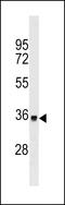 Torsin Family 1 Member A antibody, LS-C159501, Lifespan Biosciences, Western Blot image 