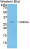 Nucleotide Binding Oligomerization Domain Containing 1 antibody, MBS2013828, MyBioSource, Western Blot image 