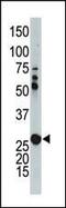 Adenylate Kinase 2 antibody, MBS9210870, MyBioSource, Western Blot image 