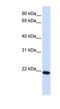 Claudin 19 antibody, NBP1-59277, Novus Biologicals, Western Blot image 