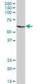 Chitinase Acidic antibody, H00027159-B01P, Novus Biologicals, Western Blot image 