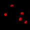 Nuclear Receptor Corepressor 2 antibody, LS-C368436, Lifespan Biosciences, Immunofluorescence image 