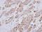 NADH:Ubiquinone Oxidoreductase Subunit A10 antibody, GTX114572, GeneTex, Immunohistochemistry paraffin image 