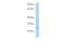 TM2 Domain Containing 3 antibody, A15600, Boster Biological Technology, Western Blot image 