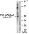 Inhibitor Of Nuclear Factor Kappa B Kinase Regulatory Subunit Gamma antibody, TA311837, Origene, Western Blot image 