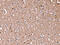 Radixin antibody, CSB-PA593723, Cusabio, Immunohistochemistry paraffin image 