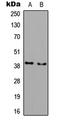 Acyl-CoA Wax Alcohol Acyltransferase 1 antibody, LS-C358419, Lifespan Biosciences, Western Blot image 