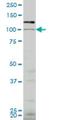 VPS18 Core Subunit Of CORVET And HOPS Complexes antibody, H00057617-M04, Novus Biologicals, Western Blot image 