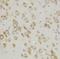 Apoptotic Peptidase Activating Factor 1 antibody, LS-C172084, Lifespan Biosciences, Immunohistochemistry paraffin image 