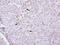 Phosphatidylinositol-4-Phosphate 5-Kinase Type 1 Alpha antibody, GTX111953, GeneTex, Immunohistochemistry paraffin image 