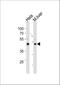 T-Box 6 antibody, A05398-1, Boster Biological Technology, Western Blot image 