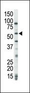 Serine/threonine-protein kinase cot antibody, MBS9211630, MyBioSource, Western Blot image 