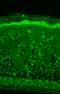 Heat Shock Protein Family B (Small) Member 8 antibody, SMC-187D-A390, StressMarq, Immunohistochemistry paraffin image 