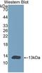 Cholinergic Receptor Nicotinic Alpha 1 Subunit antibody, LS-C699762, Lifespan Biosciences, Western Blot image 