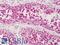 Cyclin Dependent Kinase 1 antibody, LS-B1179, Lifespan Biosciences, Immunohistochemistry frozen image 