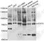 Signal Transducer And Activator Of Transcription 4 antibody, A6991, ABclonal Technology, Western Blot image 