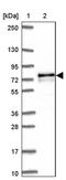 Adenylate Kinase 5 antibody, PA5-63420, Invitrogen Antibodies, Western Blot image 