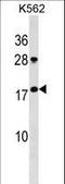 Gastrokine 1 antibody, LS-C159732, Lifespan Biosciences, Western Blot image 