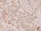 Phosphatase And Tensin Homolog antibody, A00006S364, Boster Biological Technology, Immunohistochemistry frozen image 