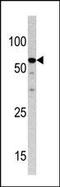 Non-SMC Condensin II Complex Subunit H2 antibody, 60-691, ProSci, Western Blot image 