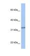 Acyl-CoA Binding Domain Containing 4 antibody, NBP1-59830, Novus Biologicals, Western Blot image 