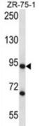 Cleavage Stimulation Factor Subunit 3 antibody, abx027771, Abbexa, Western Blot image 