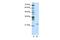 Mitochondrial RRNA Methyltransferase 1 antibody, GTX47250, GeneTex, Western Blot image 