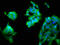 N-Acylsphingosine Amidohydrolase 2 antibody, CSB-PA002170EA01HU, Cusabio, Immunofluorescence image 