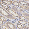 3-phosphoinositide-dependent protein kinase 1 antibody, LS-C331622, Lifespan Biosciences, Immunohistochemistry paraffin image 