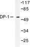 Transcription Factor Dp-1 antibody, LS-C175993, Lifespan Biosciences, Western Blot image 